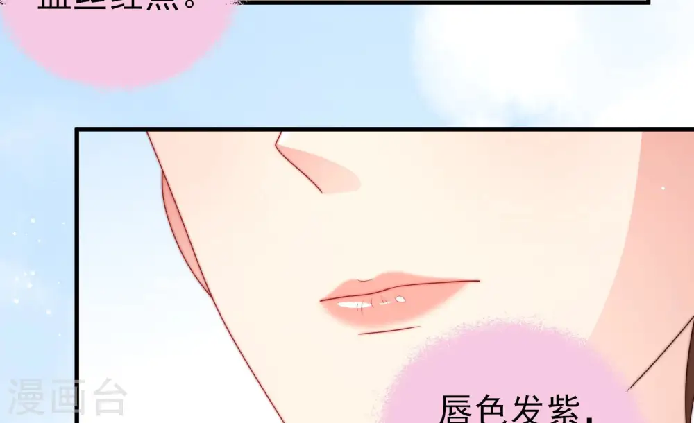第186话 毒已入骨 第61页