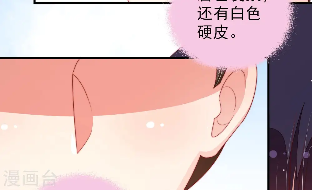 第186话 毒已入骨 第62页