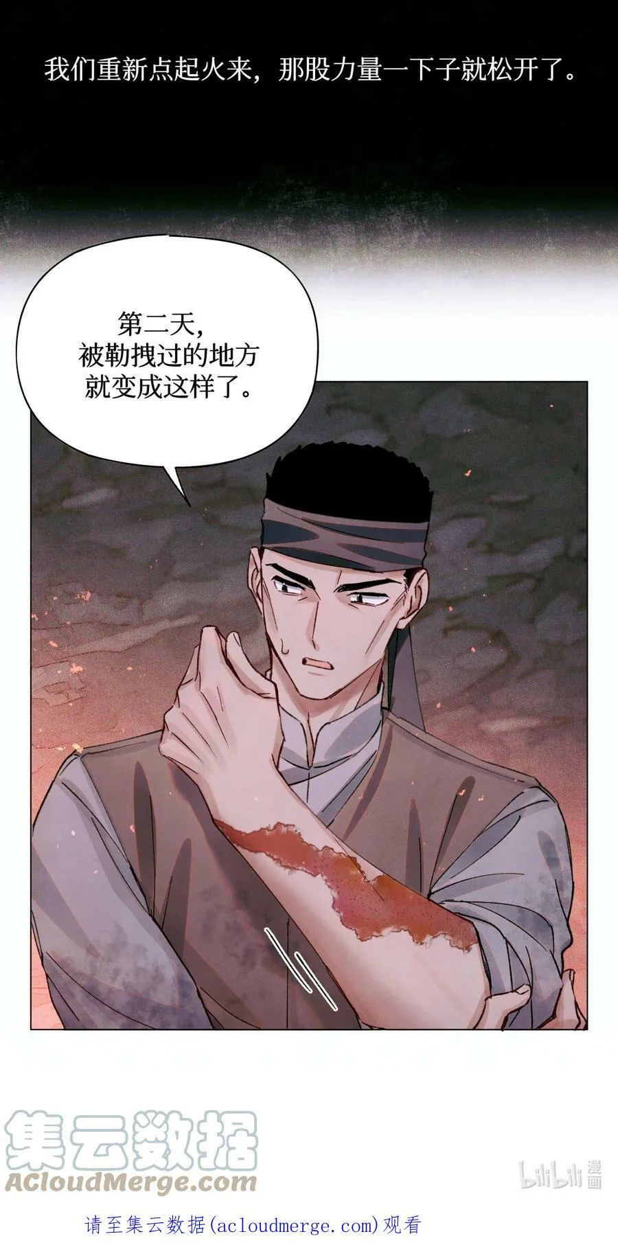 78 奇怪的伤口 第43页