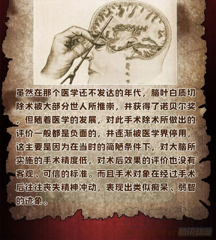 75 恶梦病 第61页