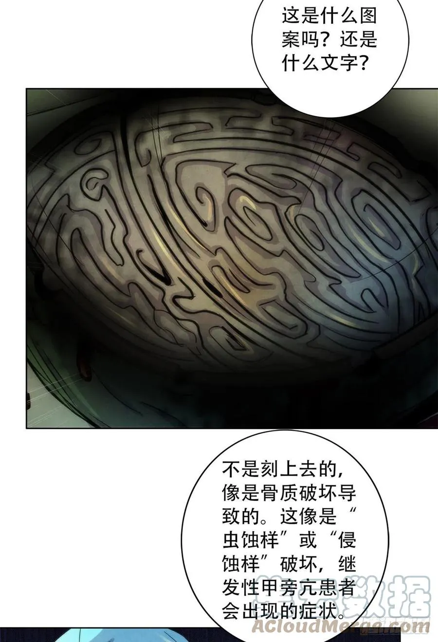 92 颅骨顶盖 第33页