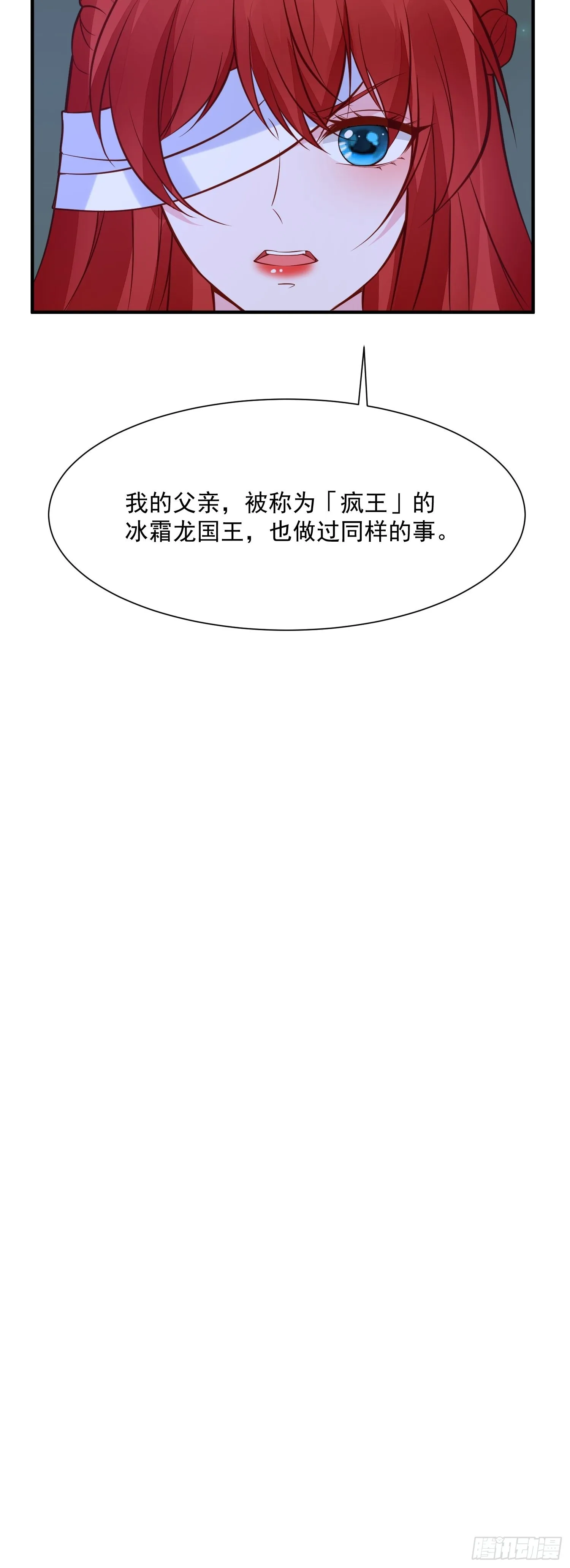 第91话 眼睛的代价 第18页