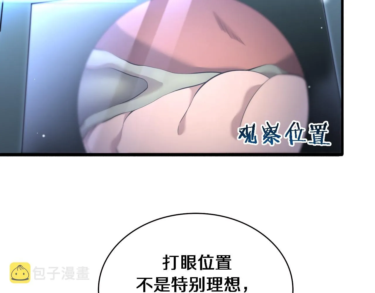 第165话 胆囊手术 第66页
