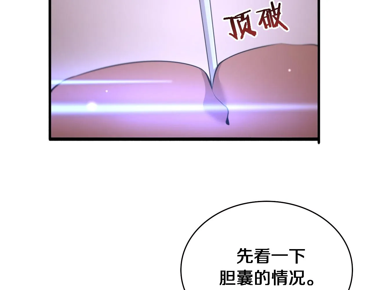 第165话 胆囊手术 第75页