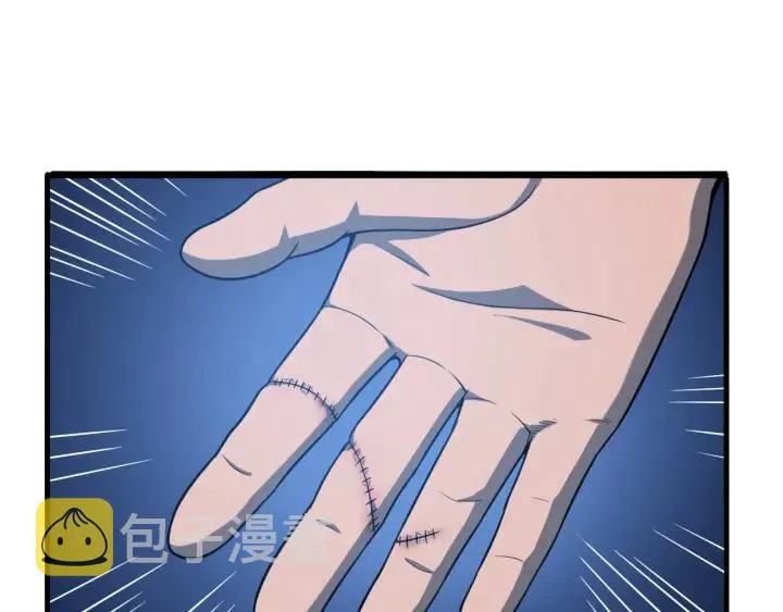 第31话 手术费 第93页