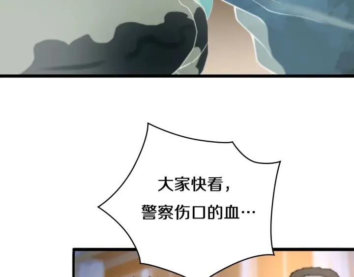 第43话 徒手止血2.0（上） 第102页