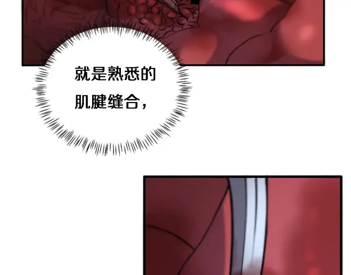 第58话 断指再植 第35页
