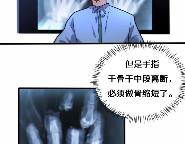 第58话 断指再植 第74页