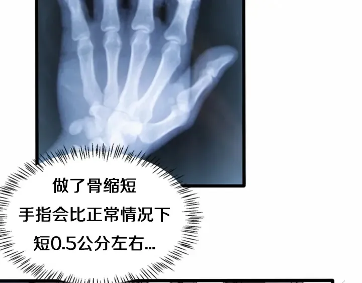 第58话 断指再植 第75页