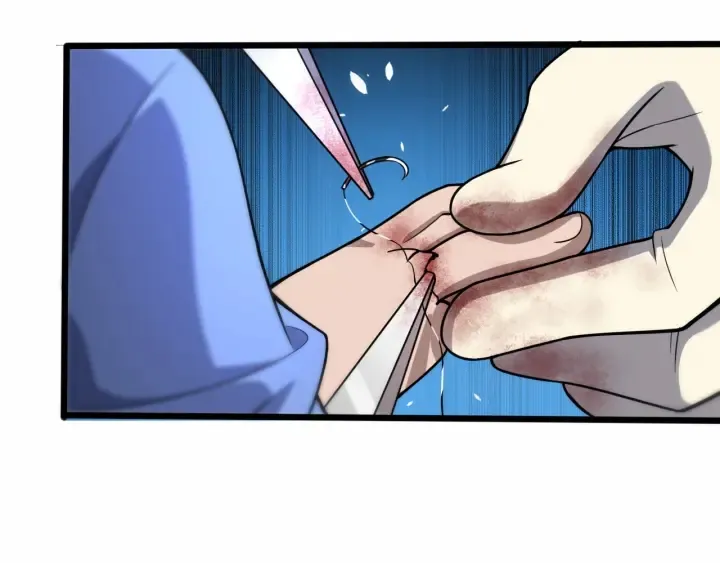 第58话 断指再植 第87页