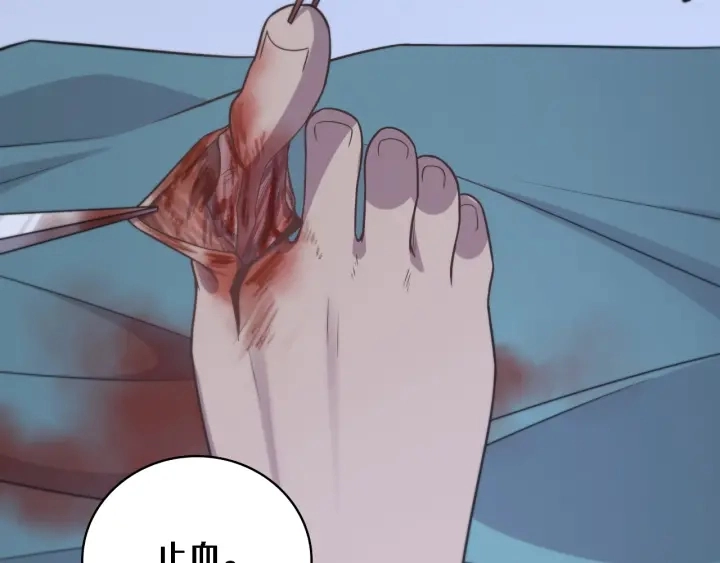 第64话 拇指缺损再造 第66页