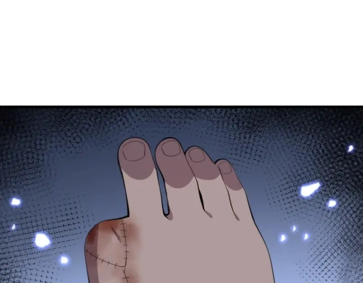第64话 拇指缺损再造 第88页