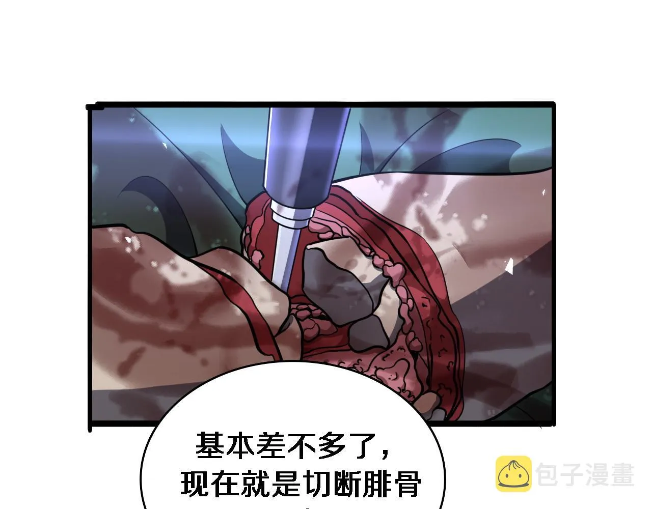 第95话 第一次做截肢手术 第85页