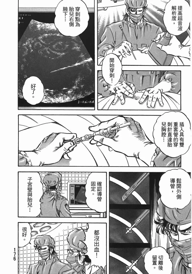 第14卷 第177页