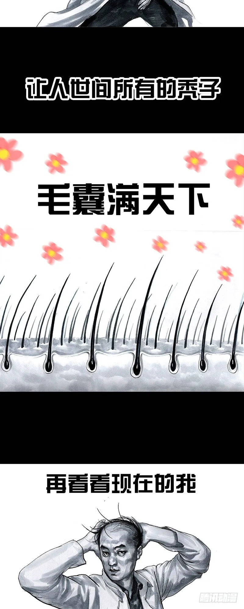 秃如其来 第35页