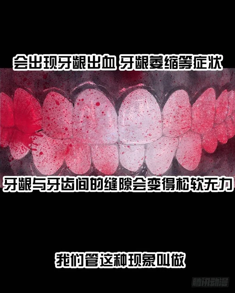 番外：拔牙 第13页