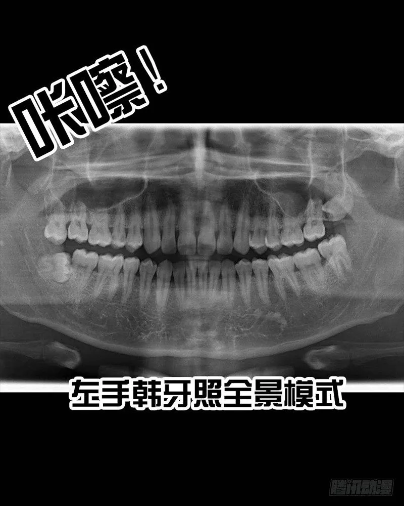番外：拔牙 第18页