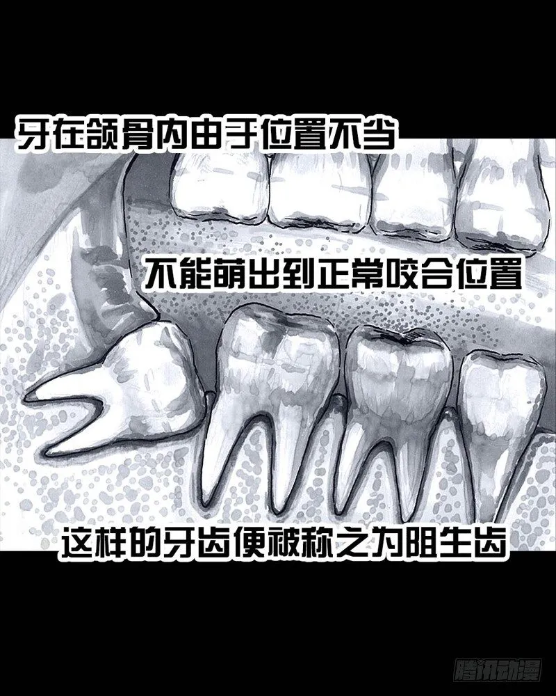 番外：拔牙 第23页