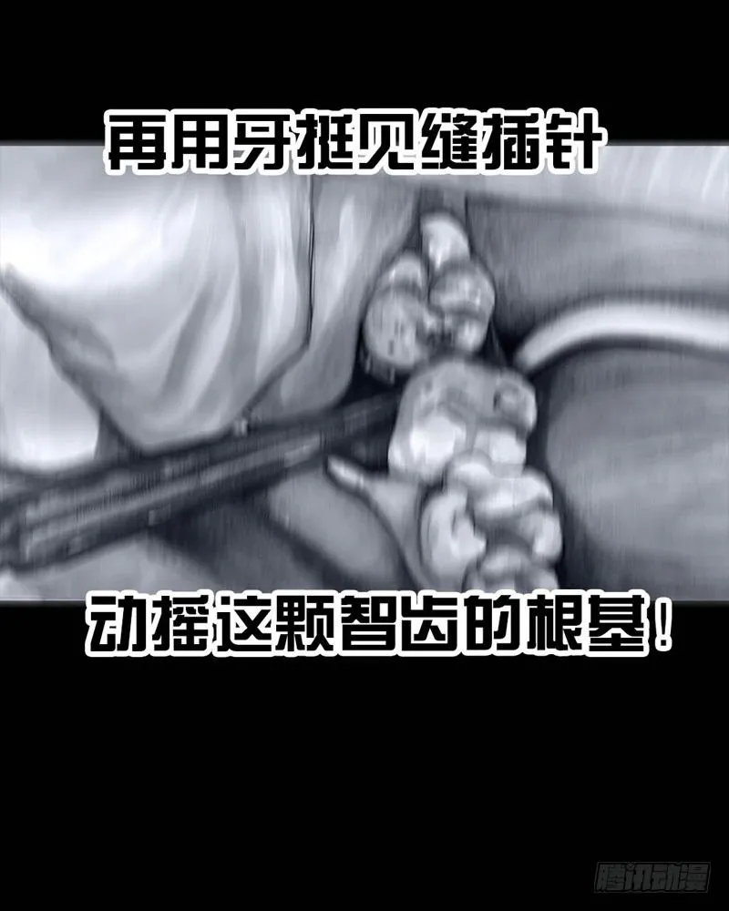 番外：拔牙 第42页