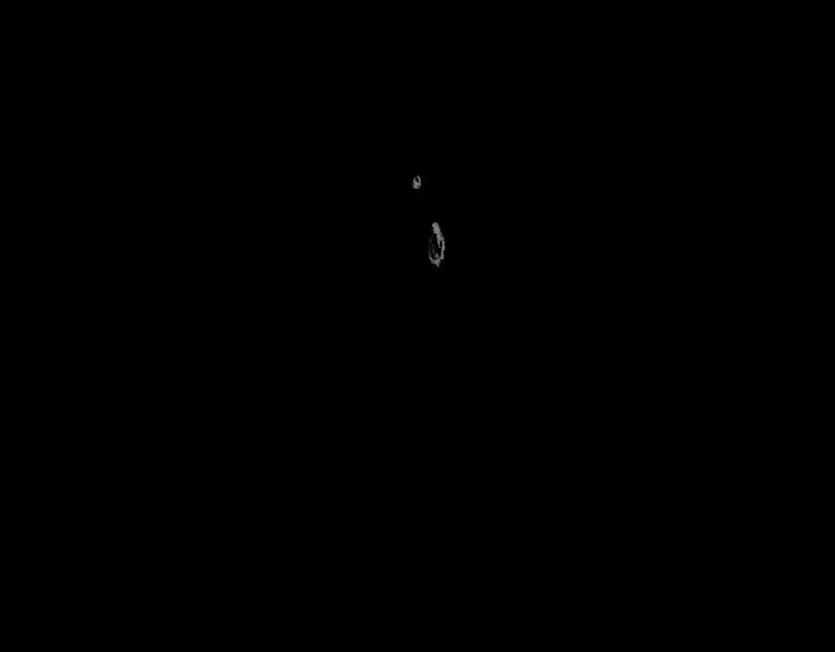 第14话 悲惨童年 第20页