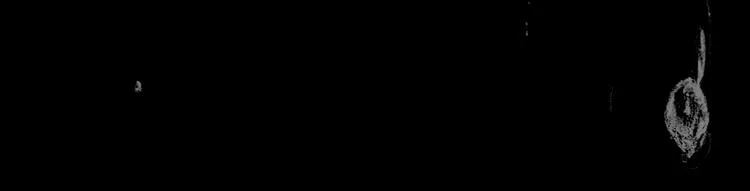 第14话 悲惨童年 第83页