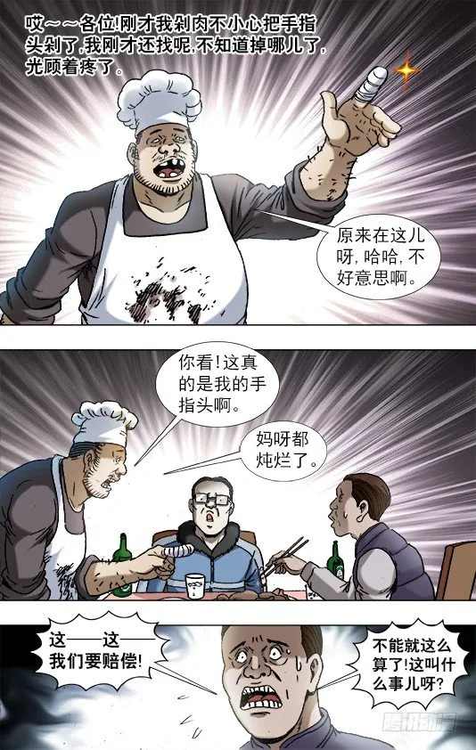 851 断手指 第5页
