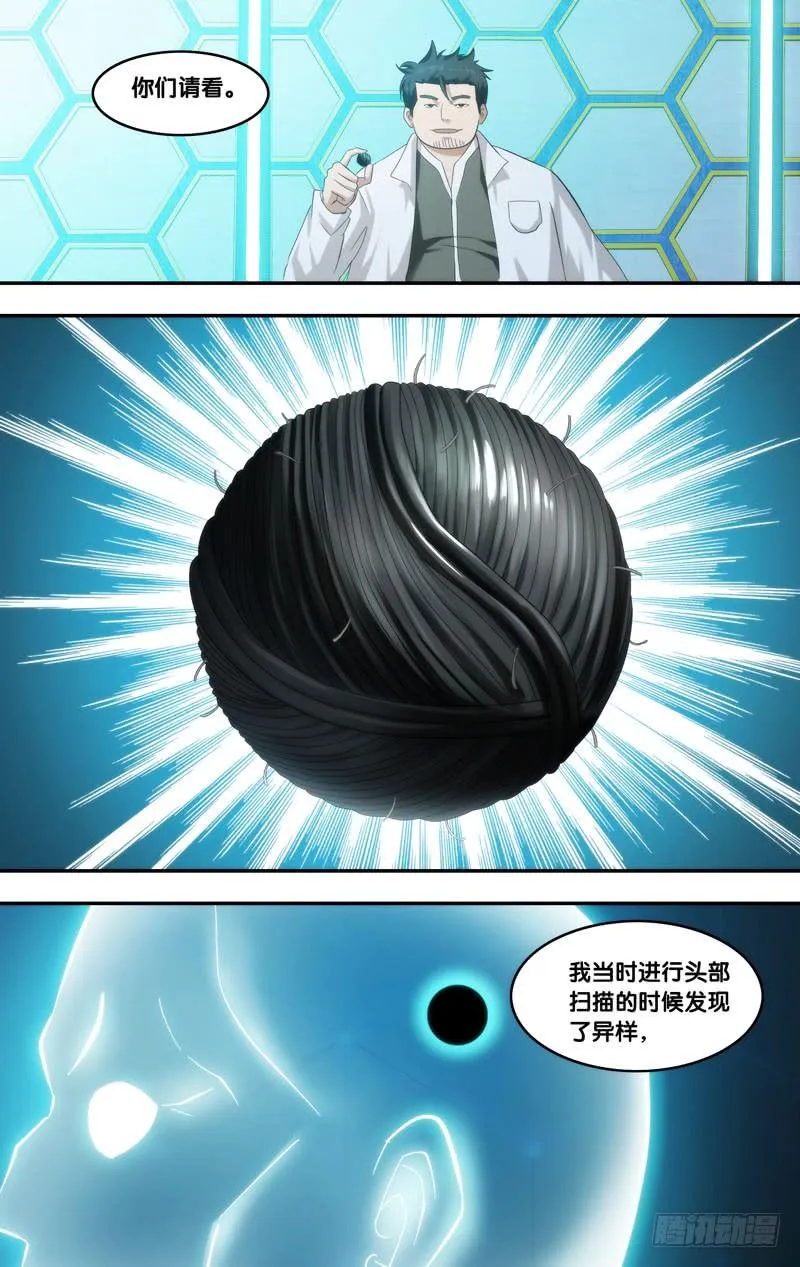 211.脑中物 第4页