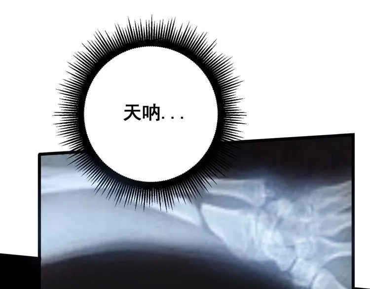 第143话 凯氏骨病 第110页