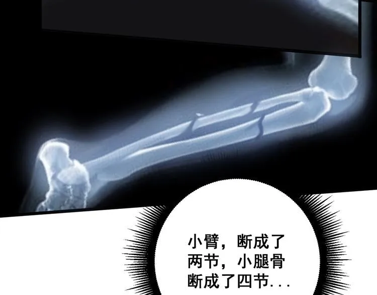 第143话 凯氏骨病 第111页