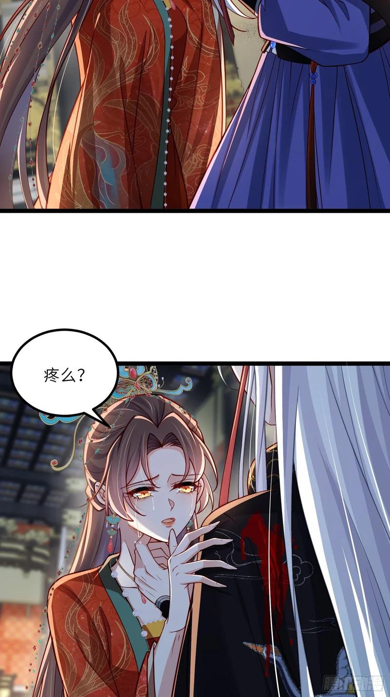 第450话 你恨我吗？ 第4页