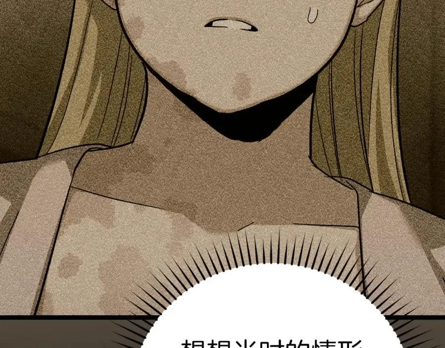第81话 僵人综合征 第30页