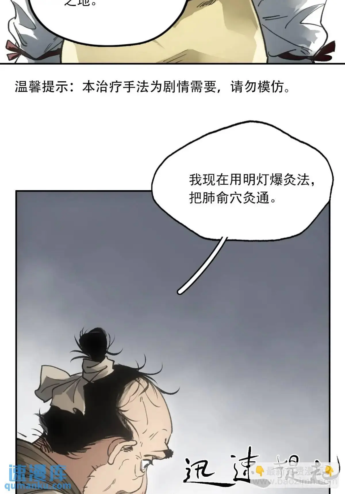 024灯火灸 第43页