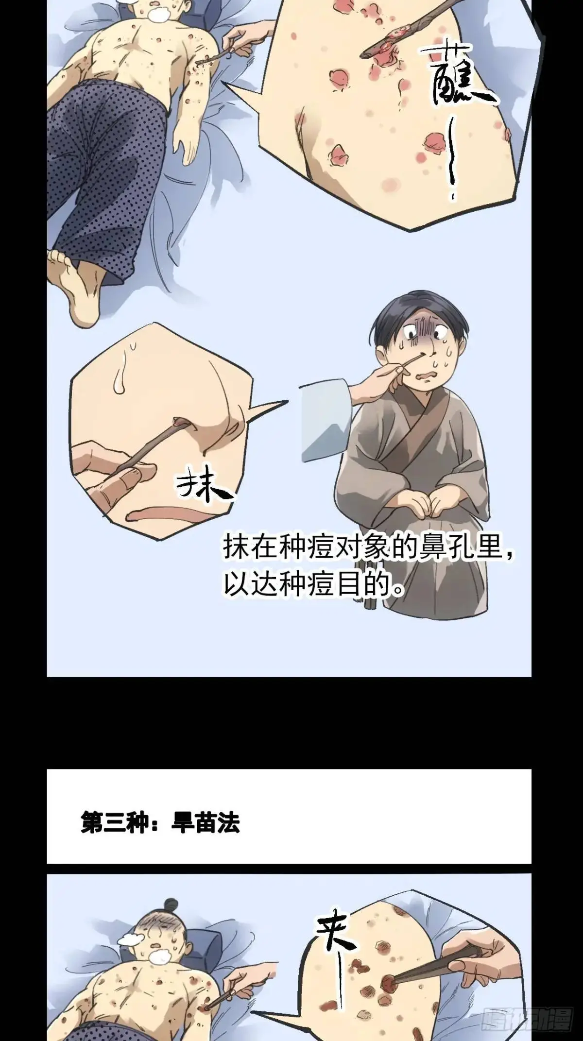 030种痘法 第28页