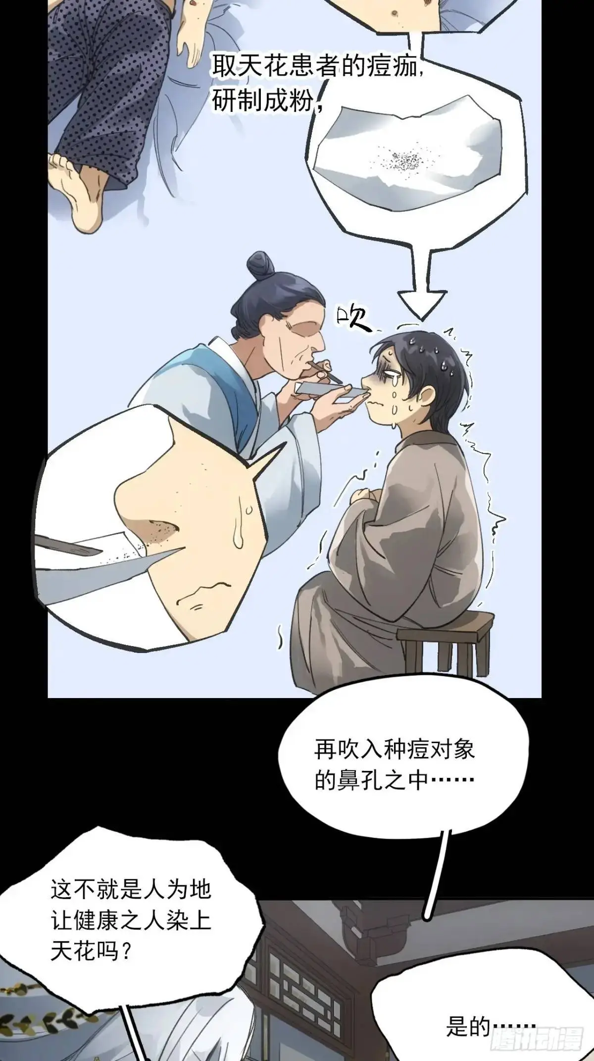 030种痘法 第29页
