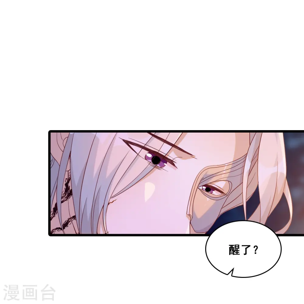 第172话 借伤撒娇？ 第17页