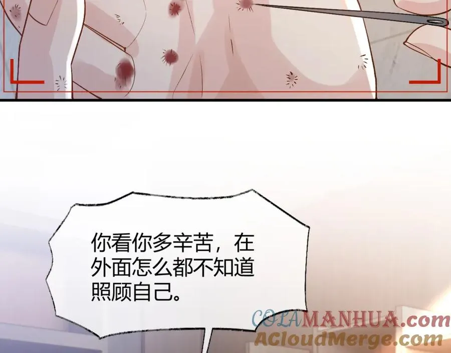 第26话 景总给修修揉手��！ 第9页