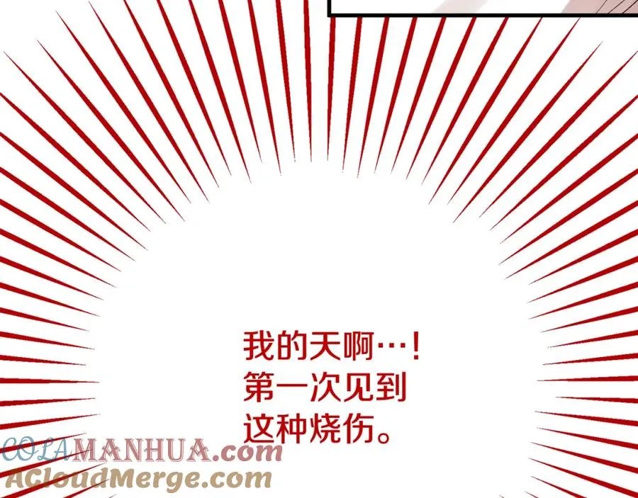 第34话 泽尔突然烧伤 第5页