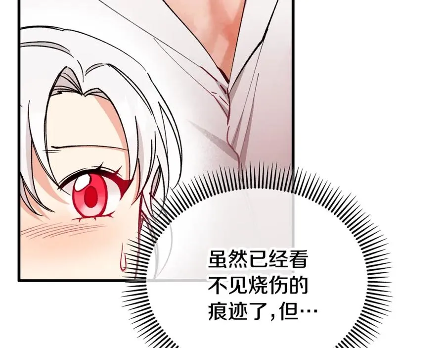 第34话 泽尔突然烧伤 第32页