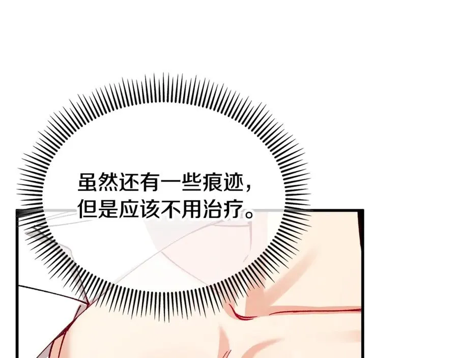 第34话 泽尔突然烧伤 第54页