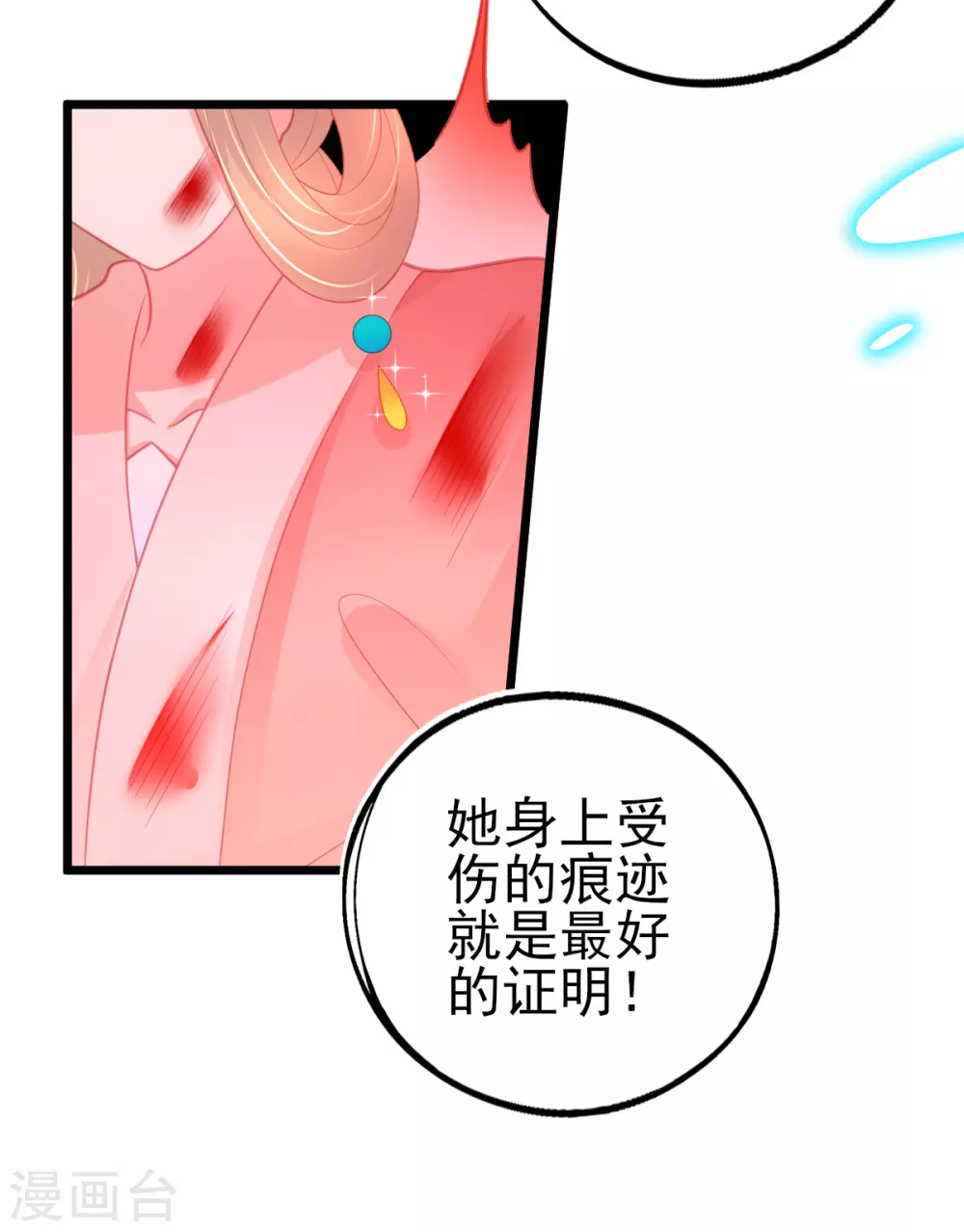 第114话 以牙还牙 第5页