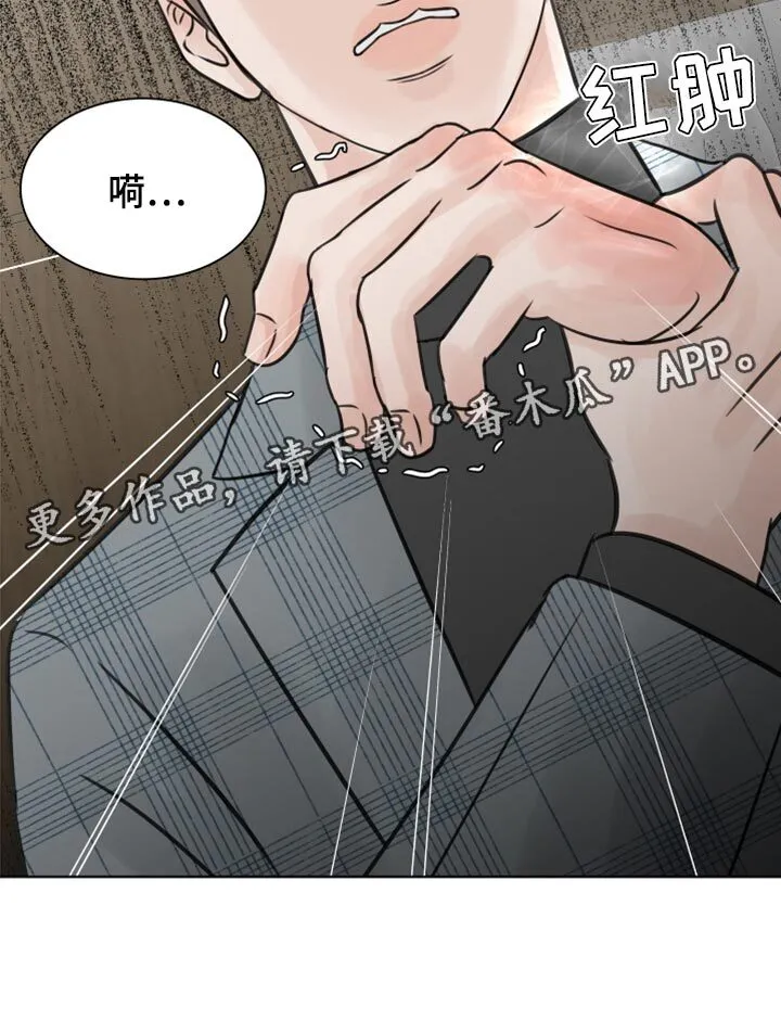 第23章：烫伤 第29页
