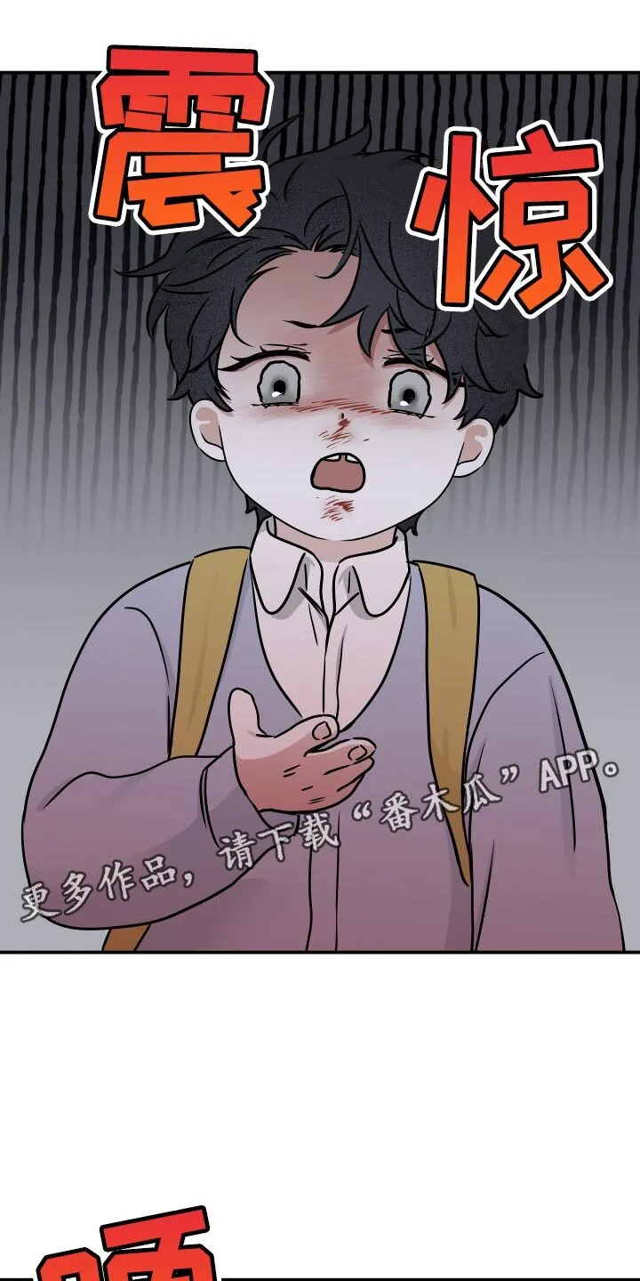 第154章：【第三季】掉牙 第16页