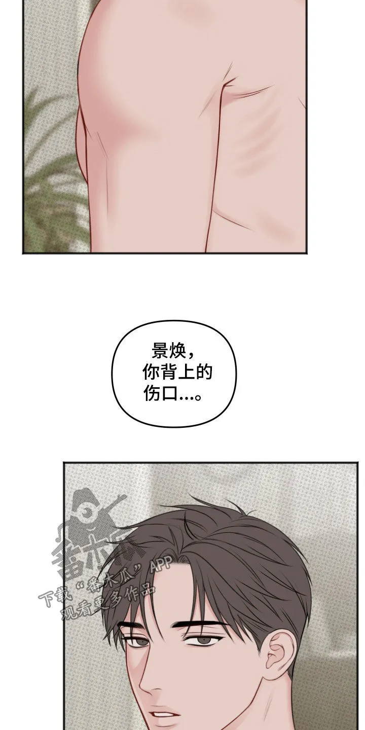第18章：伤口 第18页