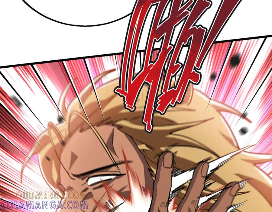 124 老大要截肢？ 第21页