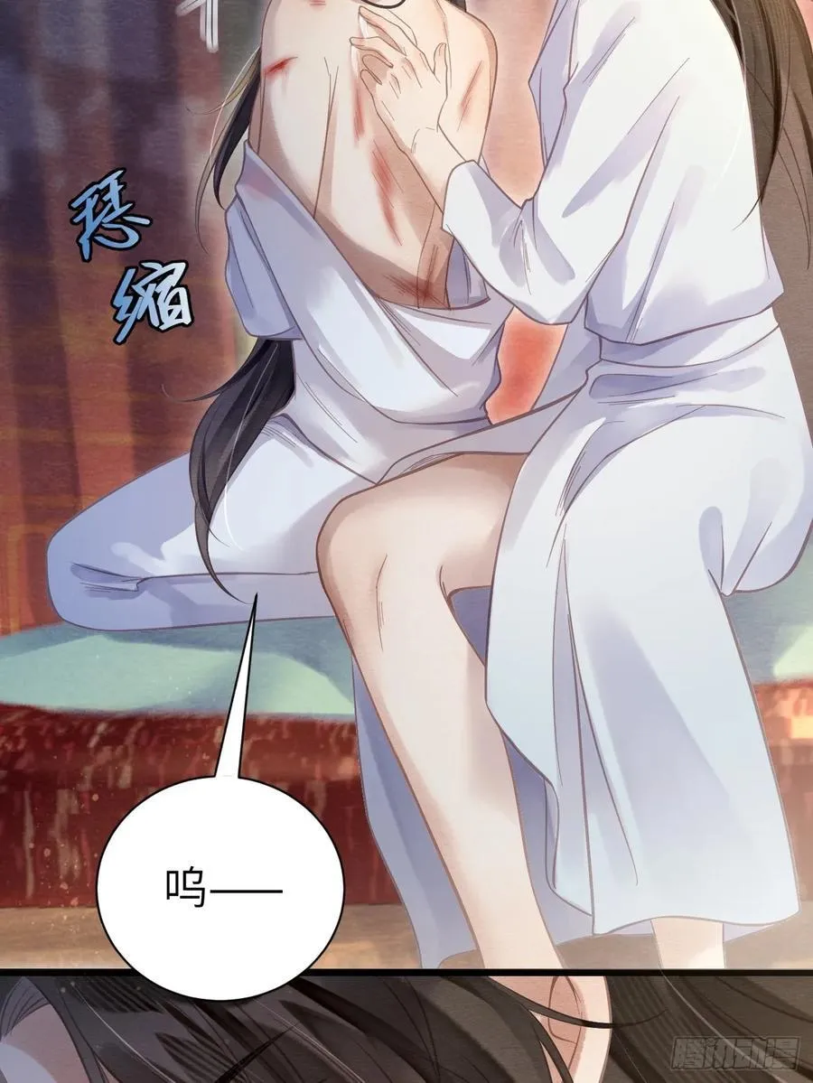 10 为他上药 第42页