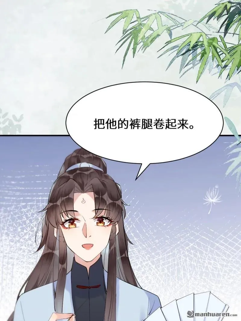 第613回 银针刺穴 第36页