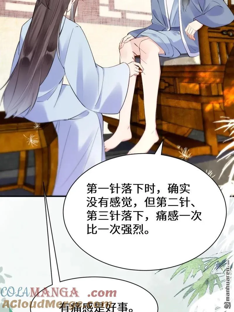 第613回 银针刺穴 第49页