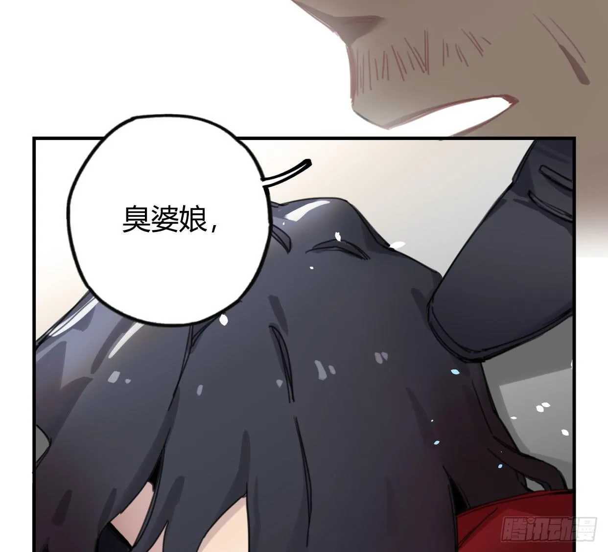颅内出血 第30页