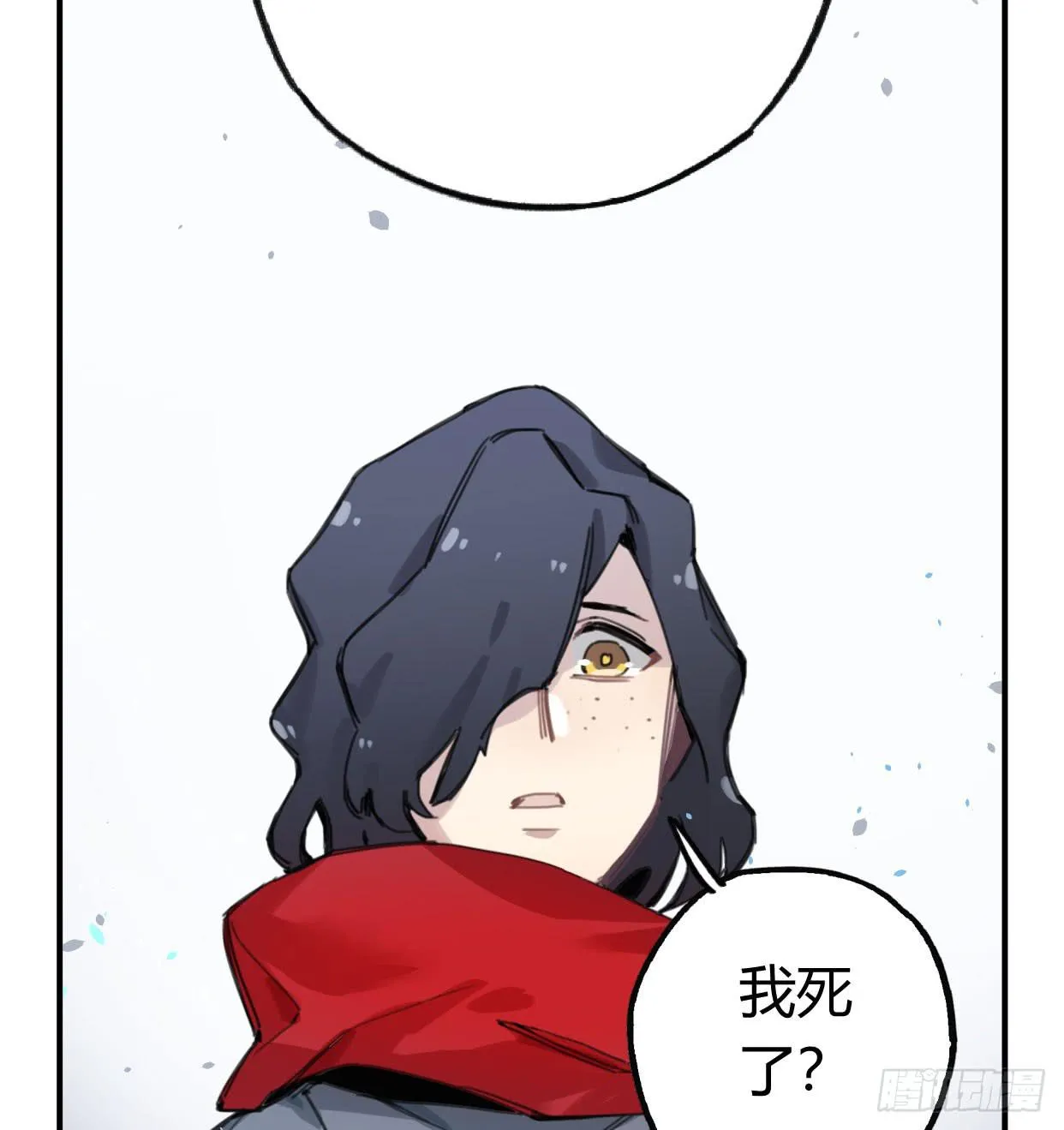 颅内出血 第44页