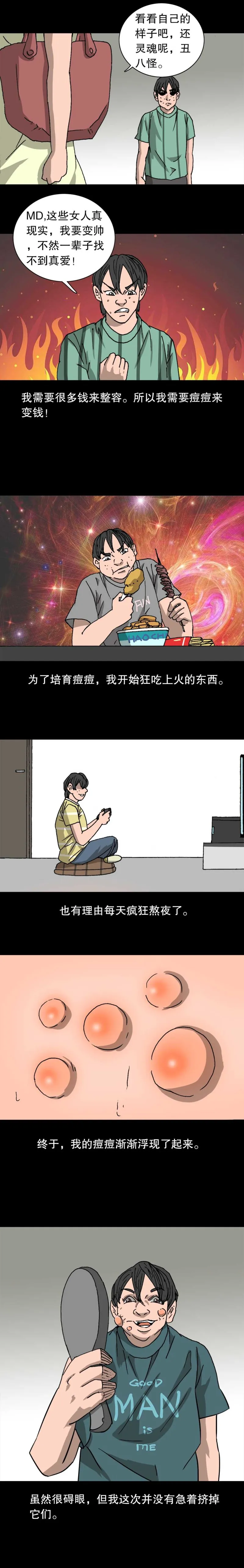 第33话 痘币男 第4页